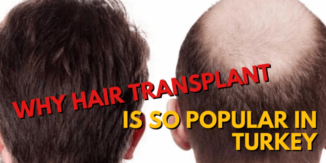 Why Hair Transplant popular in Turkey